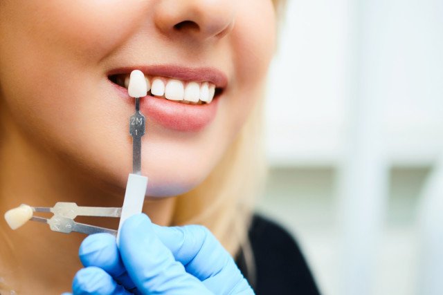 dental implants procedure in charlotte nc