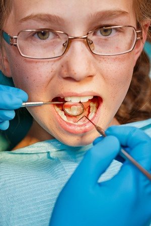  fight dental caries with regular dental visits