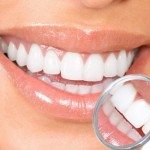 Seal Out Dental Cavities