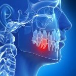 Are Sinus Infections & Tooth Aches Related?