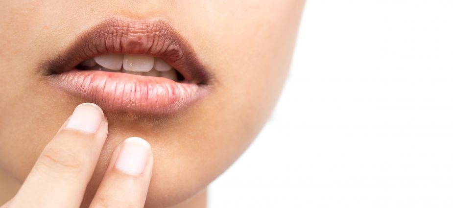 dry mouth causes symptoms and treatment