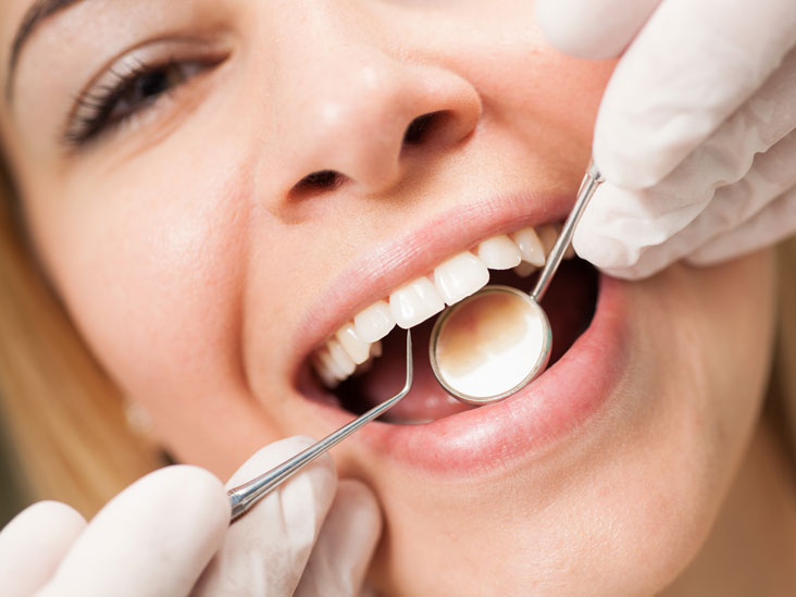 what is dental plaque