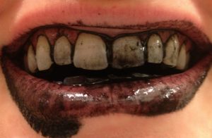 Teeth Brushed With Charcoal