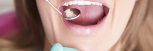 Top 5 Dental Problems for Patients in the Charlotte Area