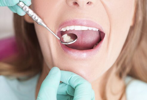 Top 5 Dental Problems for Patients in the Charlotte Area