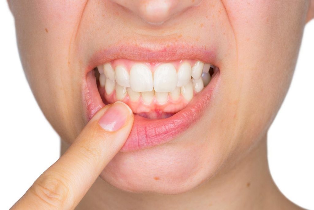 Complications of Chronic Gum Disease