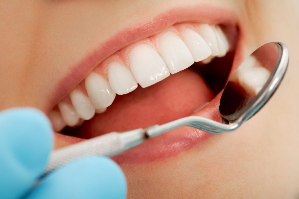 How Do Cavities Start and What Can You Do About Them