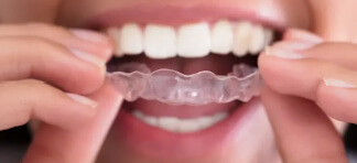Teeth Cleaning