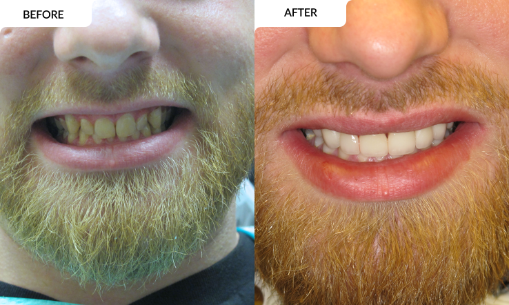 modern family dental care before and after