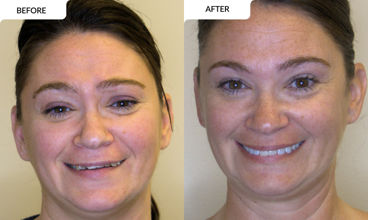 modern family dental care before and after