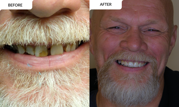 modern family dental care before and after