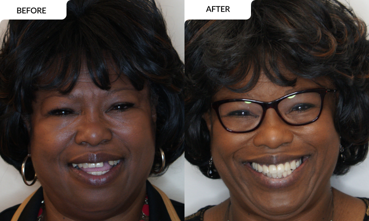 modern family dental care before and after