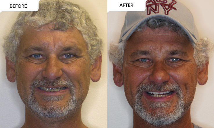 modern family dental care before and after