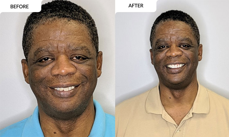 modern family dental care before and after