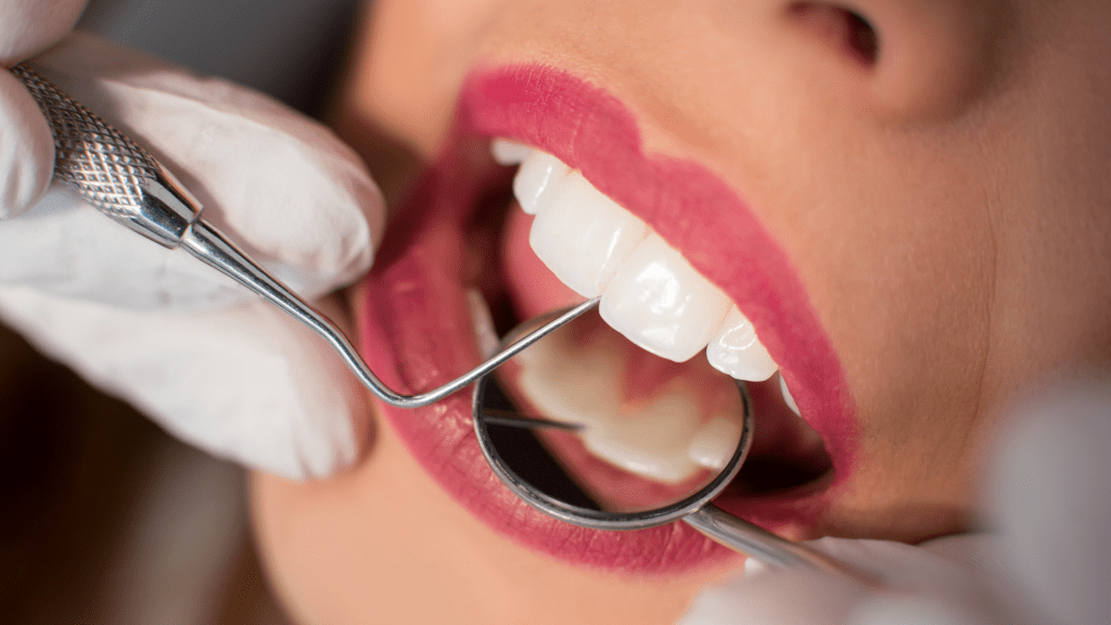 How to remove tartar without a dentist