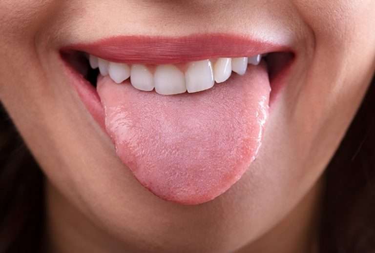 Can Dry Mouth Cause Gum Disease? Modern Family Dental Care