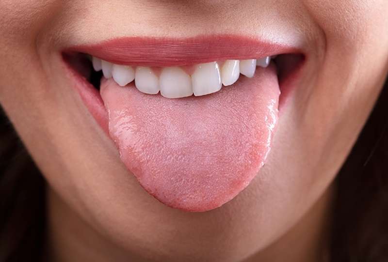 can dry mouth cause gum disease?